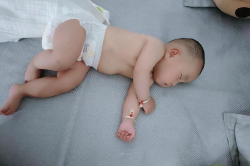 温岭六个月宝宝眼睛散光